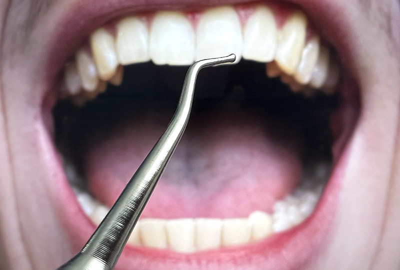 Что делать потребителю при некачественном лечении зубов