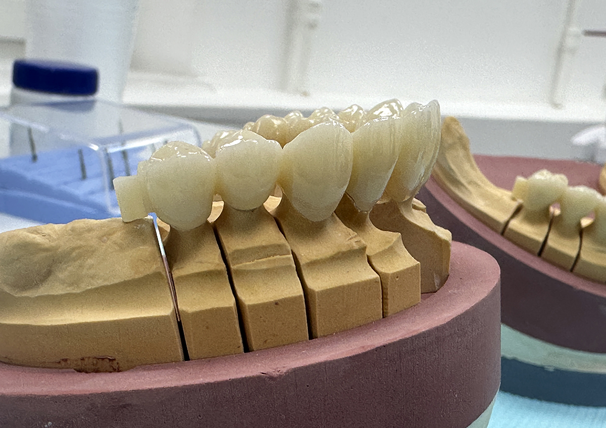 Многодетным матерям могут разрешить лечить зубы за счет маткапитала